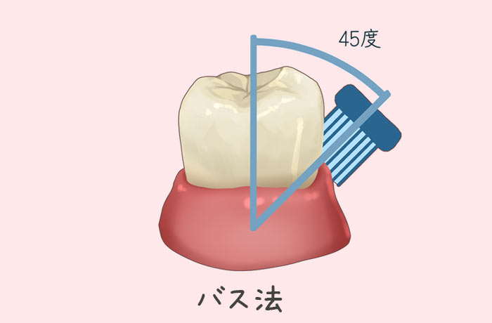 バス法による歯磨き方法の図解(歯ブラシを45度にあてて歯周ポケットを清掃)